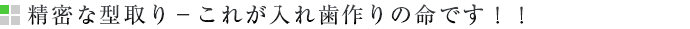 精密な型取り－これが入れ歯作りの命です！！